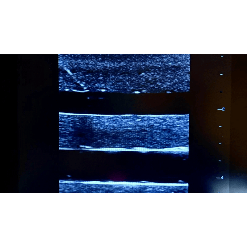 Ultrasound Simulator with 4 Central Lines