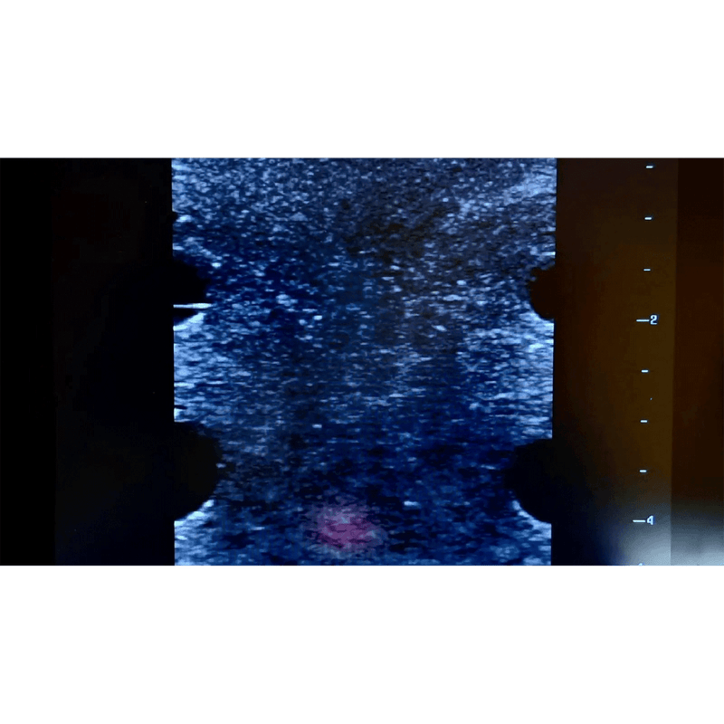 Ultrasound Simulator with 4 Central Lines