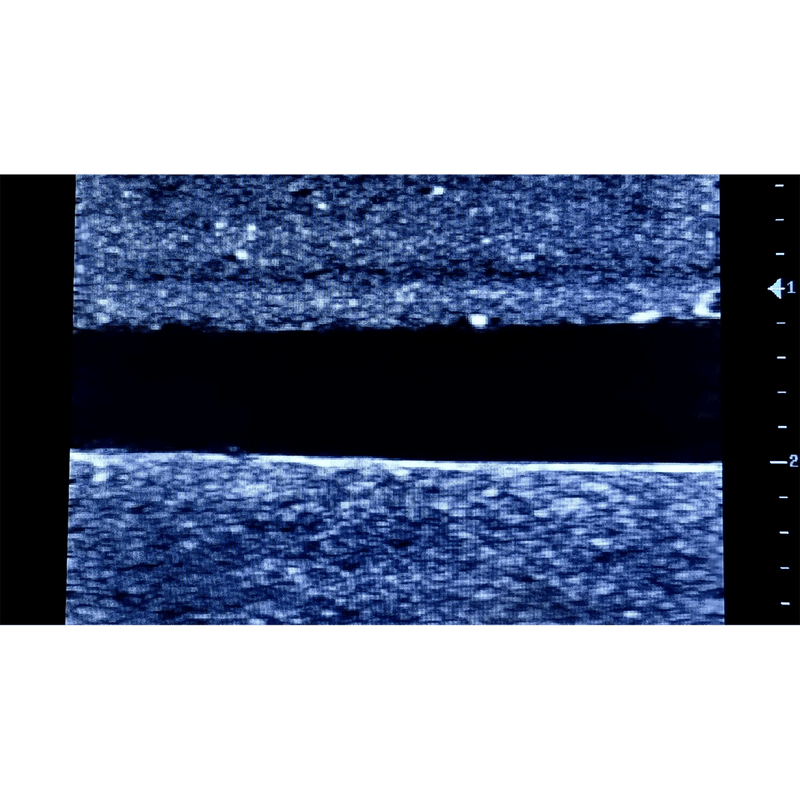 Ultrasound Simulator with 4 Central Lines