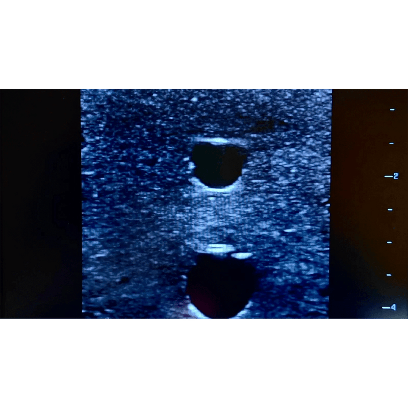 Ultrasound Simulator with 4 Central Lines