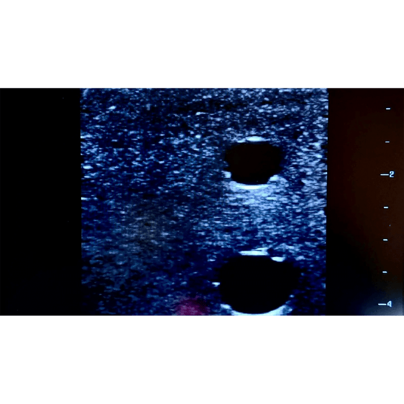 Ultrasound Simulator with 4 Central Lines