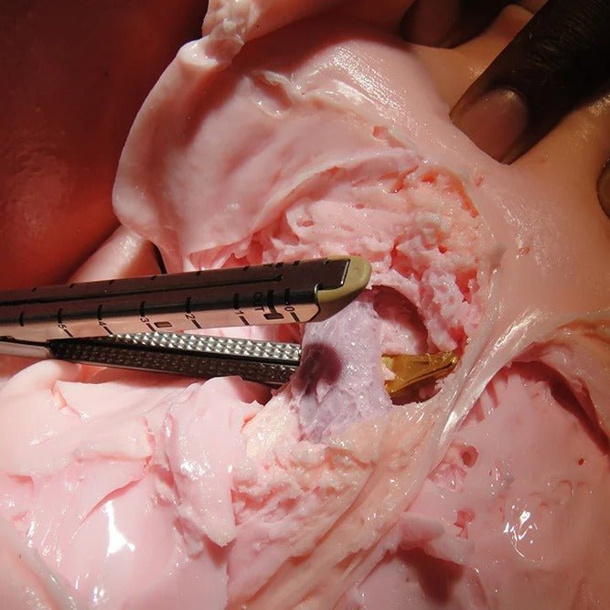 VATS Trainer with Mimetic Lung