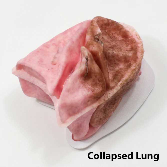 VATS Trainer with Mimetic Lung