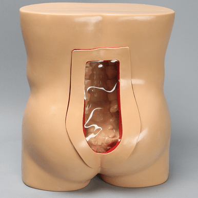 Vertebroplasty Trunk, Short