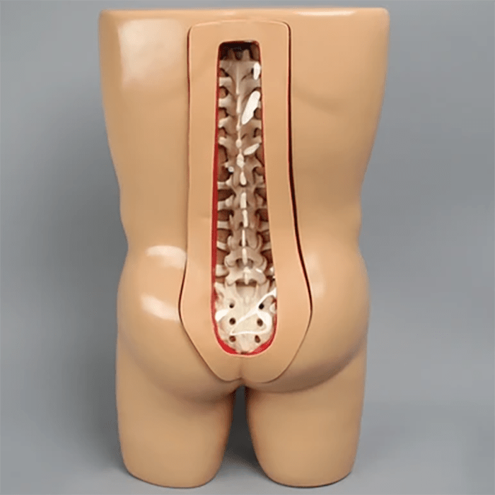 Vertebroplasty Trunk with Spine Model