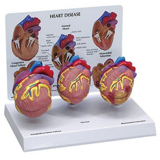 3 Mini Heart Set Models