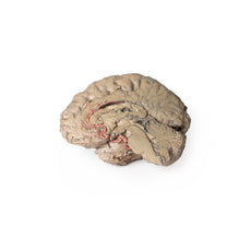 3D Printed Brain Hemisection