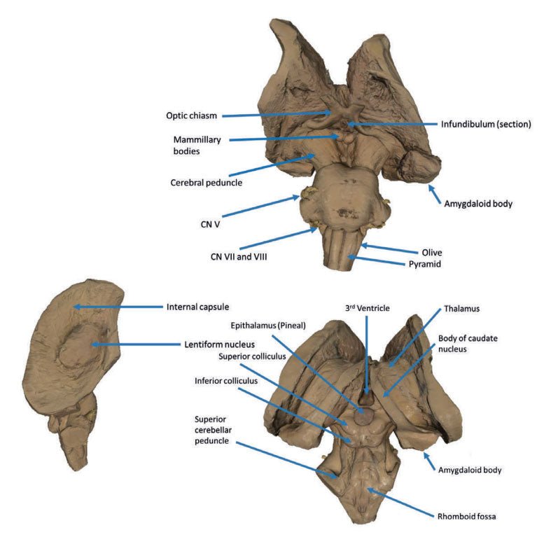 3D Printed Brain Stem, Deep Cerebral and Diencephalic Structures