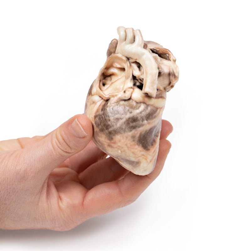 3D Printed Congenital Pulmonary Stenosis