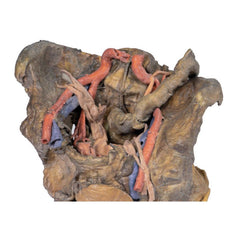 3D Printed Female Pelvis Deep Dissection