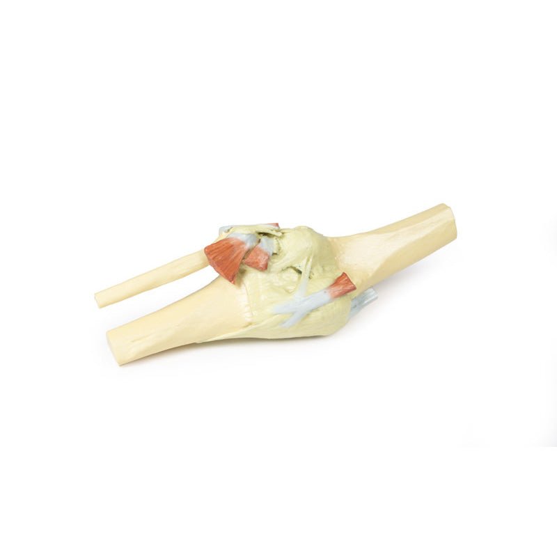3D Printed Knee Joint extended Model