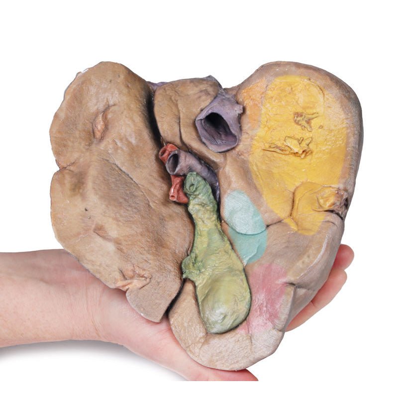 3D Printed Liver with Vessels and Gallbladder