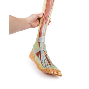 3D Printed Lower Limb Models – Tagged 