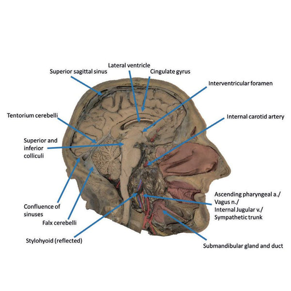 Sagittal Cut Dissection Example Mid Sagittal Section Through