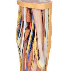 3D Printed Popliteal Fossa distal thigh and proximal leg