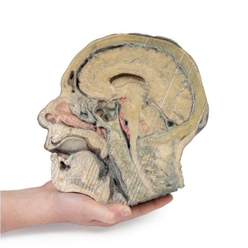 3D Printed Sagittal Section of Head with Infratemporal Fossa Dissection