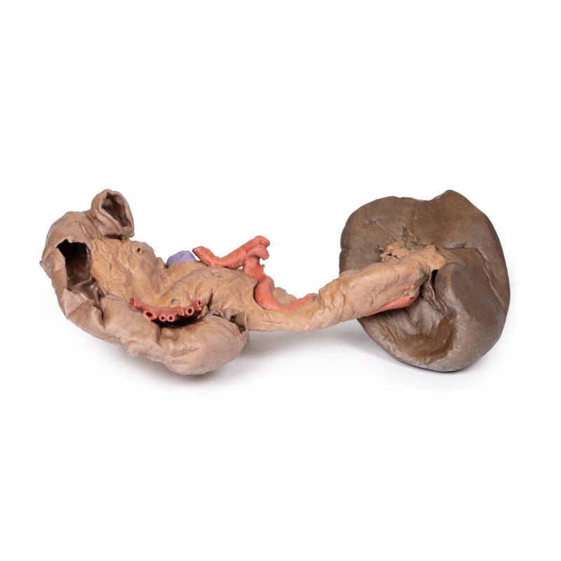 3D Printed Spleen and Pancreas
