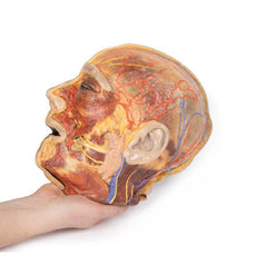 3D Printed Superficial Facial Nerves & Parotid Gland