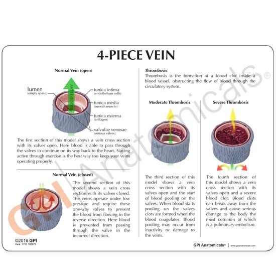 4-Piece Vein Model