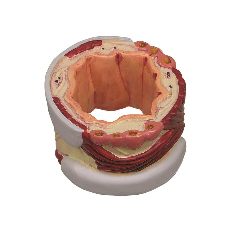4-stage cross-section Bronchus Model