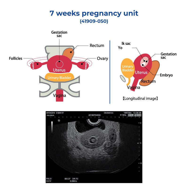 7week 7 Weeks Pregnancy Unit – GTSimulators.com
