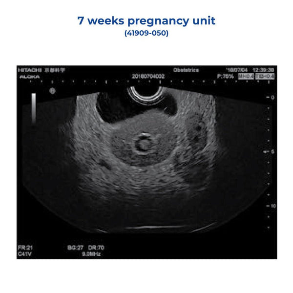 7 Weeks Pregnancy Unit – GTSimulators.com