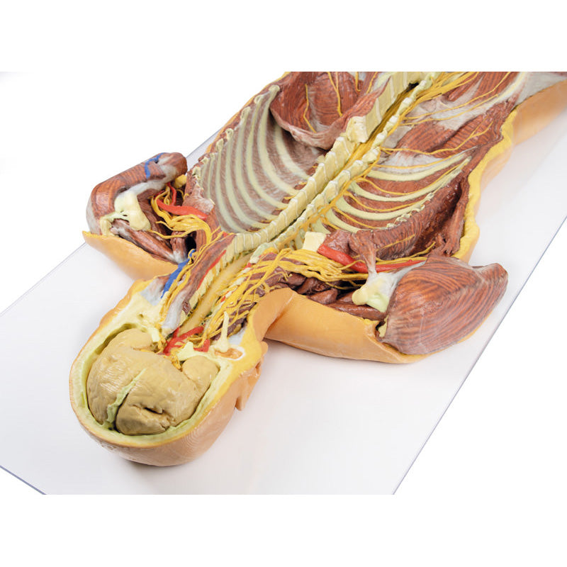 3D Printed Posterior Body Wall - Ventral Deep Dissection