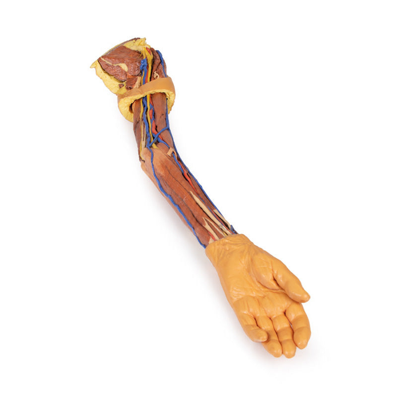3D Printed Upper Limb Replica