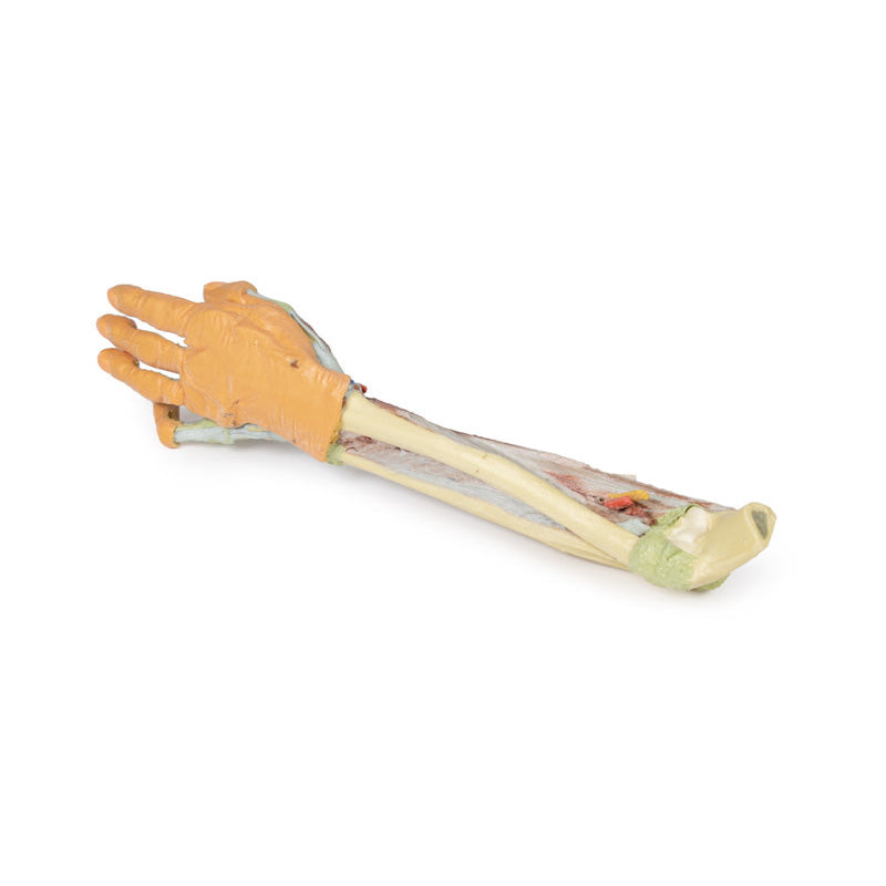 3D Printed Forearm and Hand with Deep Dissection