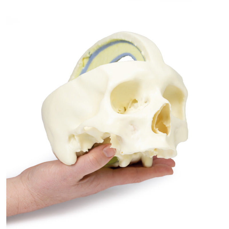 3D Printed Dural Skull Model