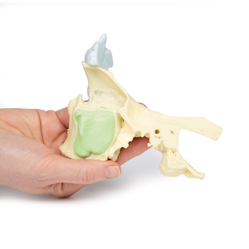 3D Printed Paranasal Sinus Model