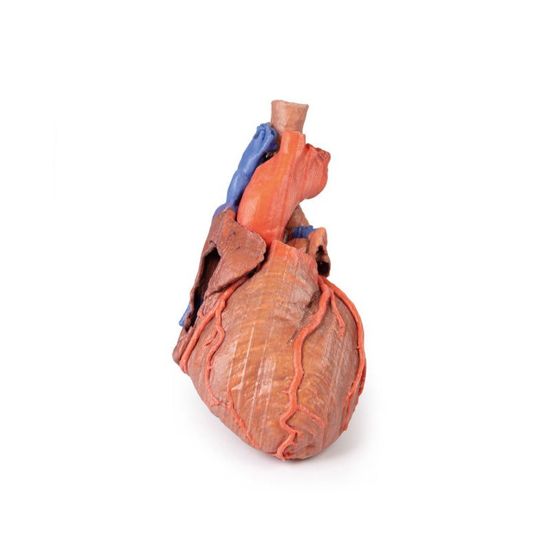 3D Printed Heart and the distal trachea, carina and primary bronchi
