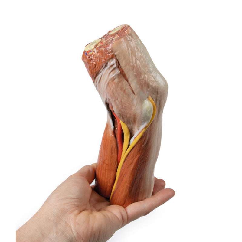 3D Printed Cubital fossa model with muscles and brachial artery