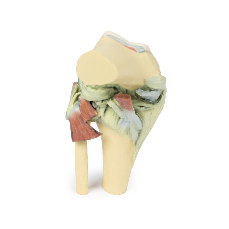 3D Printed Knee Joint Model