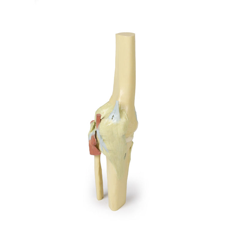 3D Printed Knee Joint extended Model