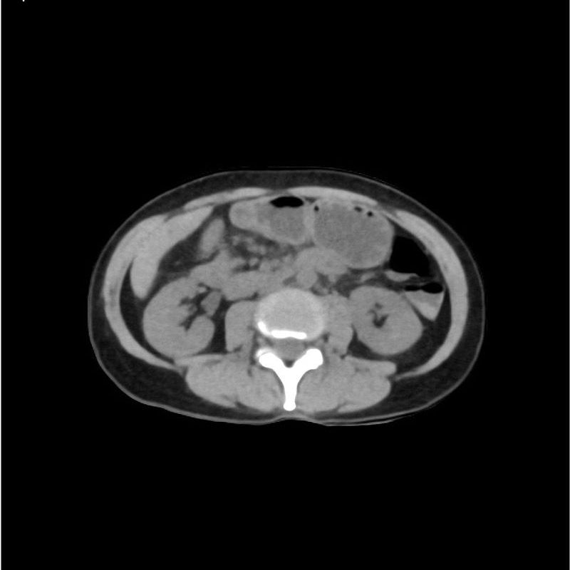 Native Abdomen and Pelvis Phantom for CT Scan and X-Ray Training ...