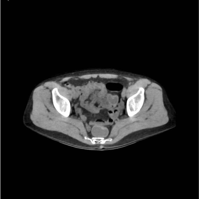 Native Abdomen and Pelvis Phantom for CT Scan and X-Ray Training ...