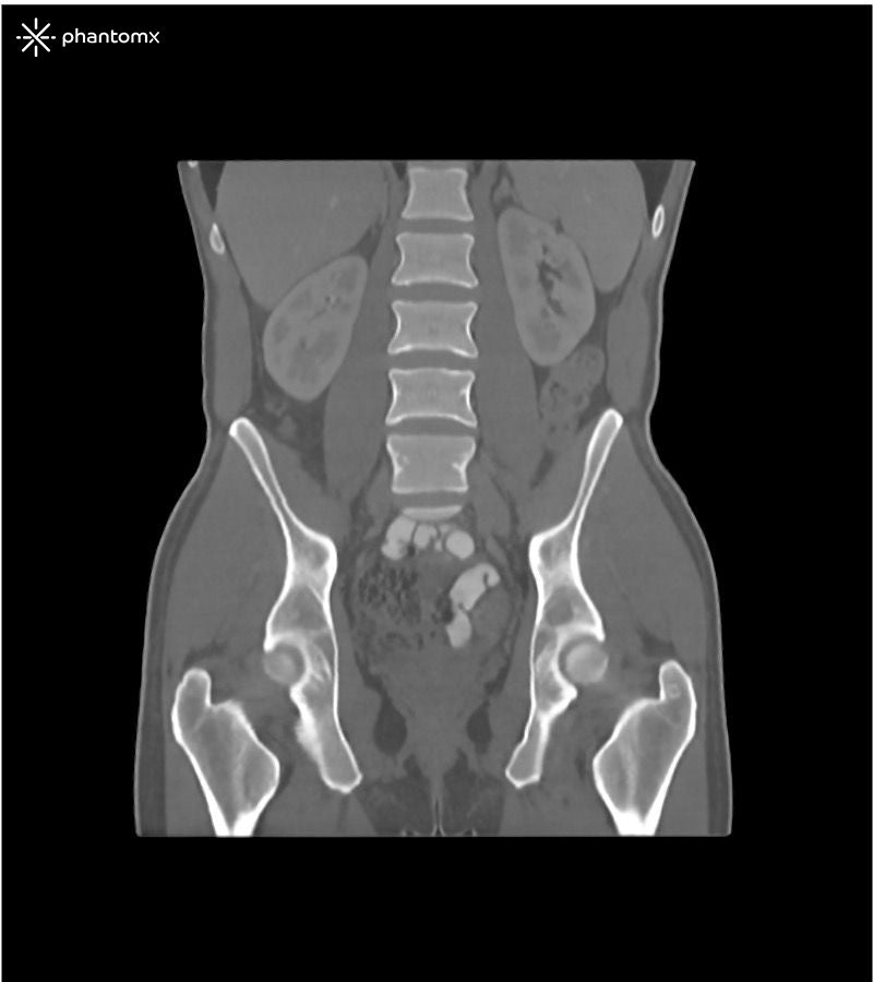 Portal Venous Phase Abdomen and Pelvis Phantom for CT Scan and X-Ray Training