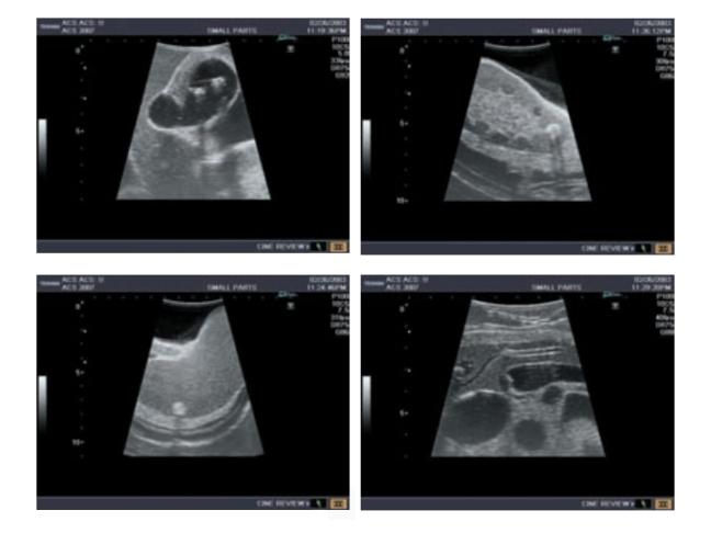 Abdominal Intraoperative and Laparoscopic Ultrasound - IOUSFAN