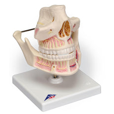 Adult Dentures - Lower Jaw Movable