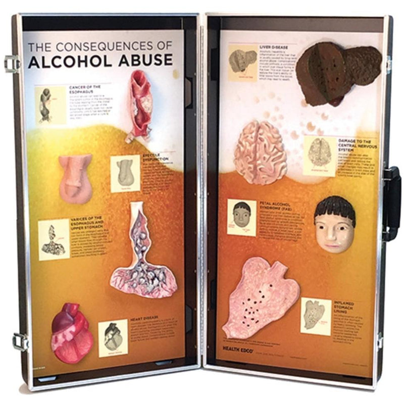 Alcohol Abuse Consequences 3D Display