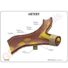 Artery Model with Cut-Away