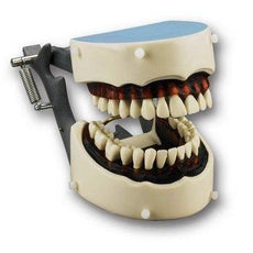 Articulated Dental Hygiene Dentoform w- soft gingival insert