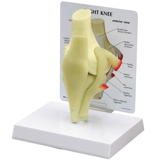 thumbnail image 2 of Anatomical Human Degenerative Knee Joint Disease Model – Medical Skeleton Anatomy By Sorekarain 2 of 2
