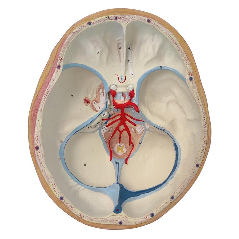 Brain with Arteries on Base of Head, 8 part