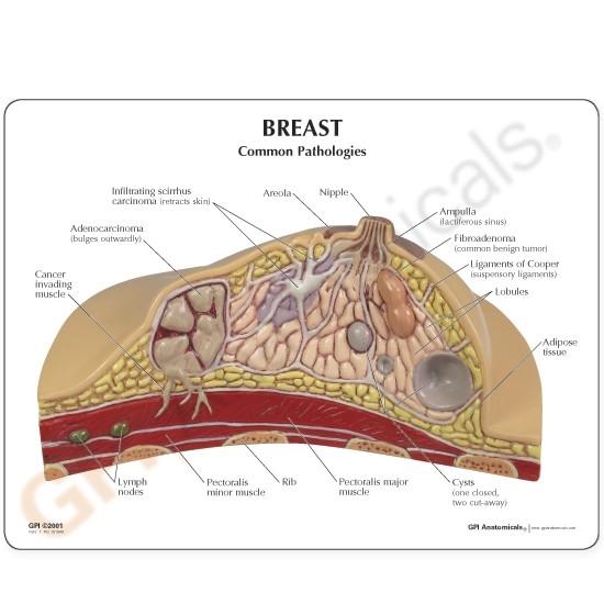 Breast Cross Section Model with Pathologies