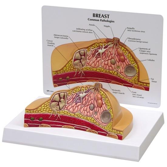 Breast Cross Section Model with Pathologies
