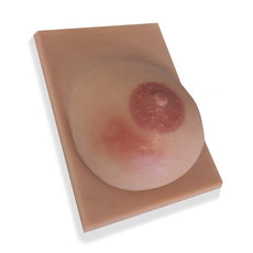 Breast With Mastitis