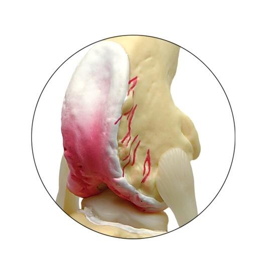 Canine 4-Stage Osteoarthritis Knee Model