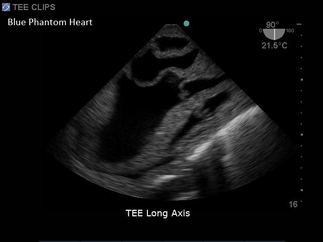 Cardiac Echo Ultrasound Training Model